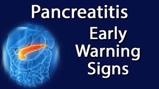 Pancreatitis  Early Warning Signs [upl. by Muraida]