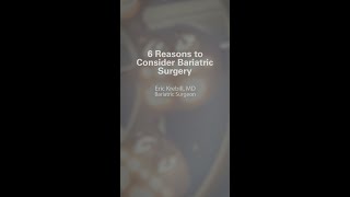 6 Reasons to Consider Bariatric Surgery  6 in 60 [upl. by Rika]