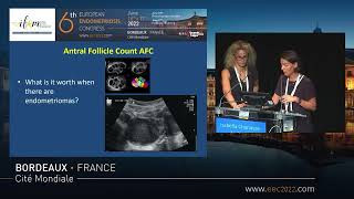 Surgery or ART Session at the 6th European Endometriosis Congress Bordeaux 2022 [upl. by Brebner]