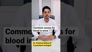 Common causes for blood in urine explained in Tamil by urologist doctor doctor health urologist [upl. by Buchheim]