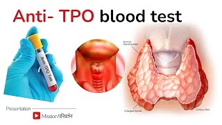 AntiTPO antibodies  treatment for high antiTPO [upl. by Kuth]