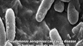 Pseudomonas aeruginosa Infections [upl. by Legnaleugim]