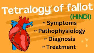 Tetralogy of fallot  Circulatory System and Disease  NCLEXRN  Khan Academy [upl. by Everara]