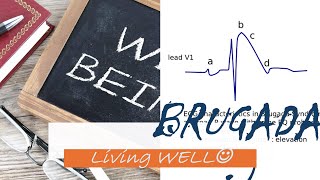 Living WELL with BRUGADA SYNDROME  CardiacAwareness HeartHealth LiveWell [upl. by Auguste]