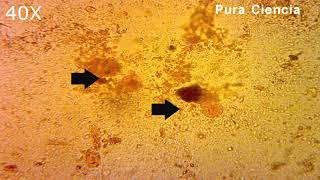 Entamoeba coli Microscope 40x Lugol Coprológico  Pura Ciencia [upl. by Mall]