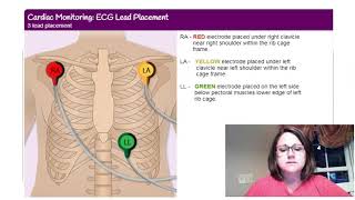 How to place 3 lead EKG [upl. by Tani]