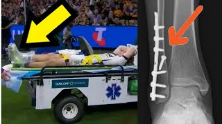 Ryan Papenhuyzens SEASON ENDING ANKLE FRACTURE Explained [upl. by Rhianna]