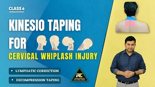 How to Tape Arthrosis or Cervical Spine Extension Problems Using CureTape Kinesiology Tape [upl. by Enicar]