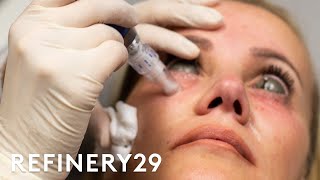 The Truth About This Controversial Injection Trend  Shady  Refinery29 [upl. by Anelim918]