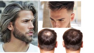 How to Master Mens Hair Care Defeating Hair Loss and Dandruff [upl. by Asoral]