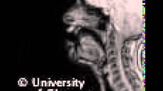 MRI voiced alveolar approximant [upl. by Lester890]