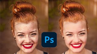 High End Skin Retouching in photoshop  How to Remove Blemishes [upl. by Notlek]