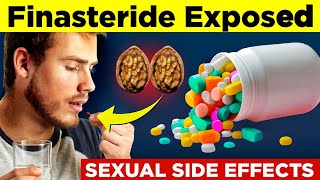 5 Finasteride SIDE EFFECTS Exposed that will SHOCK YOU 🤯  Finasteride Results [upl. by Huberty391]