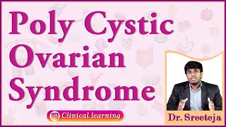 27 Poly Cystic Ovarian Syndrome  PCOS [upl. by Zaller]