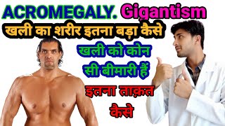 खली का शरीर इतना बड़ा केसे हुआ खली को कोनसी बीमारी है what is AcromegalyAcromegaly gigantism [upl. by Wyne]