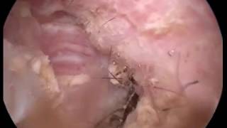 Ear wax cleaning in dog Otoscopy wwwendovetcom [upl. by Niawd]