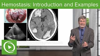 Hemostasis Introduction and Examples  Cellular Pathology [upl. by Elconin]