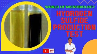 Hydrogen Sulfide Production Test Tamil  Biochemical Test  SIM Sulfide Indole MotilityMedium [upl. by Hollinger]