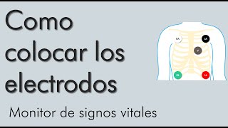 Como colocar los electrodos monitor de signos vitales  video 2 [upl. by Anerol]