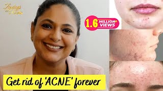 Skin Tightening Home Remedies  चेहरे पर कसाव कैसे लाएं [upl. by Celin]