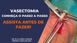 Como é feita a Vasectomia Conheça os detalhes da cirurgia  Dr Élio Arão Júnior [upl. by Curtice]