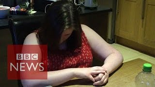 Narcolepsy What is it like to have a cataplexy attack  BBC News [upl. by Tse]