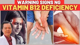 9 Warning Signs na Kulang Ka sa Vitamin B12  By Doc Willie Ong [upl. by Nollad643]