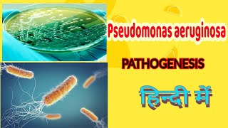 Pseudomonas aeruginosa pathogenesis lab diagnosis amp treatment  microbiology in hindi [upl. by Yreffoeg682]