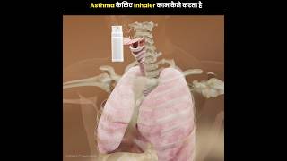 How does Inhaler Work for Asthma [upl. by Allanson]