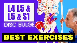 L4 L5 amp L5 S1 Disc Bulge Best Exercises Rehab For Relief [upl. by Fenwick]