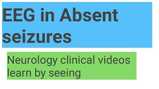 EEG in absent seizures [upl. by Elocen764]