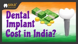 Cost of Dental Implant in India dental implant cost india  dental implants cost in india [upl. by Nywled962]