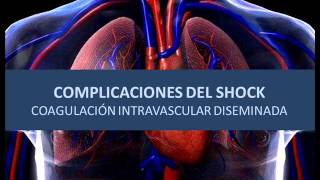 Complicaciones del shock  Coagulacíon intravascular diseminada [upl. by Akzseinga]