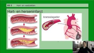 Basisstof 5 Hart en vaatziekten [upl. by Orrin158]