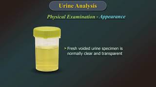 Urine Analysis [upl. by Ylrae]