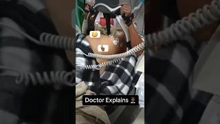 Doctor explains the ROBOT CPR MACHINE shorts medical [upl. by Convery]