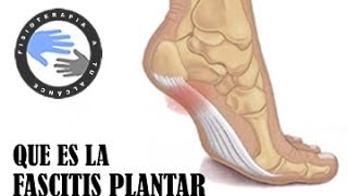 Fascitis plantar que es y como se produce [upl. by Bush]