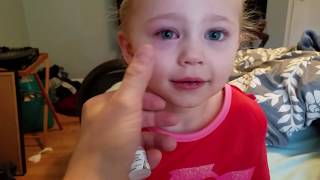 The best way to do eyedrops on a child [upl. by Gingras]