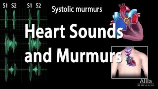 Heart Sounds and Heart Murmurs Animation [upl. by Llerroj]