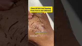 🔥Get Fair Feet in 5MinutesRemove Suntan Easily At HomeEasy pedicureskincare shorts viralvideo [upl. by Melak]