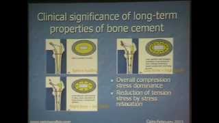 Bone cement and cementing techniques  Prof Foad Zamel By D Mohamed Abo Elsoaud [upl. by Kletter]