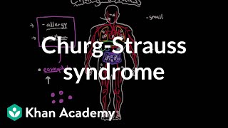 ChurgStrauss syndrome  Circulatory System and Disease  NCLEXRN  Khan Academy [upl. by Clo]