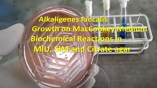 Alkaligenes faecalis Colony Morphology on Macconkey agar and Biochemical Reactions Demonstration [upl. by Berny]