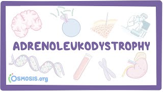 Adrenoleukodystrophy  causes symptoms diagnosis treatment pathology [upl. by Lehteb]