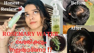 🥀💦 മുടി കൊഴിച്ചിൽ മാറും 🔥Result 💯‼️ Rosemary Water Alps GoodnessBEING US BY AJ [upl. by Atiekahs]