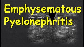 Emphysematous Pyelonephritis [upl. by Delmore48]