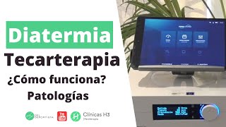 ¿Qué es la tecarterapia Patologías indicadas ✅ Diatermia Madrid Clínicas H3 [upl. by Ahsiuqet]