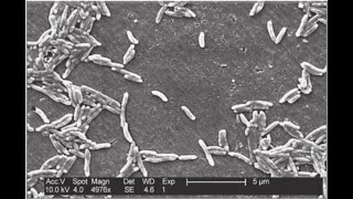 Campylobacter jejuni [upl. by Hurleigh]