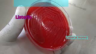 Listeria on blood agar [upl. by Rrats]