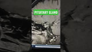 Pituitary Gland  Guess the Sequence shorts youtubeshorts shortsfeed [upl. by Nahum319]